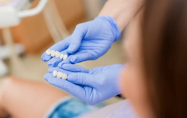 Dental Bridges