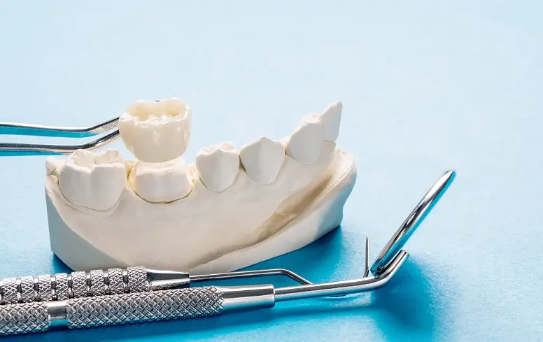 Dental Crowns