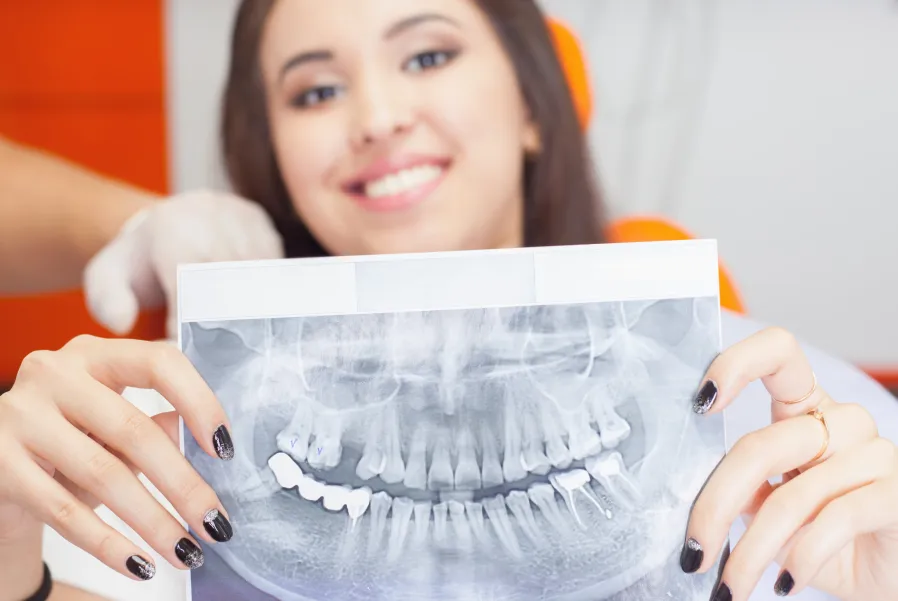Digital Dental X-Rays in Missouri City, TX
