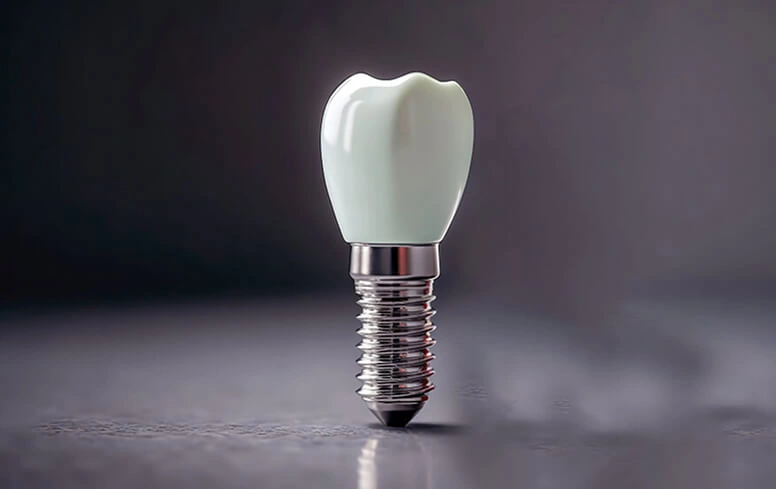 Dental Implant